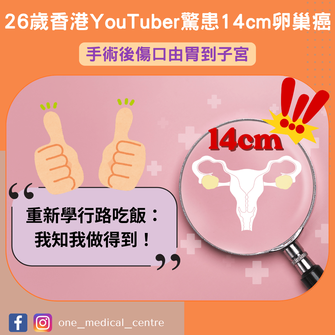 【26歲香港YouTuber驚患14cm卵巢癌　手術後傷口由胃到子宮　重新學行路吃飯：我知我做得到】